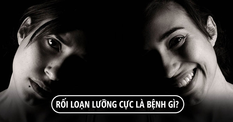 Rối loạn lưỡng cực