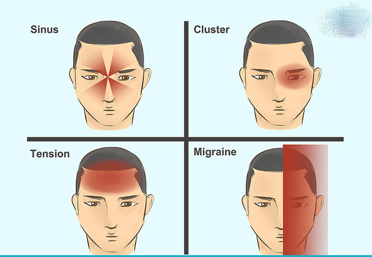 đau đầu chóng mặt đau đầu chóng mặt