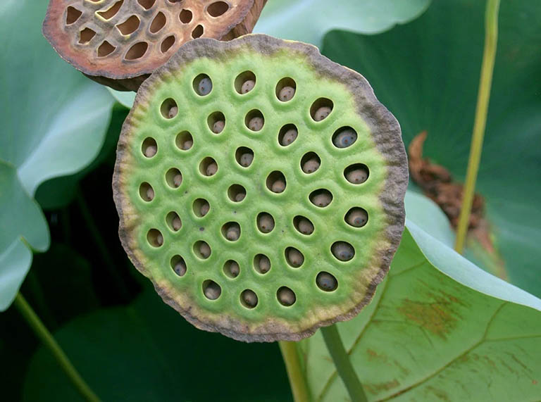 bệnh sợ lỗ bệnh sợ lỗ