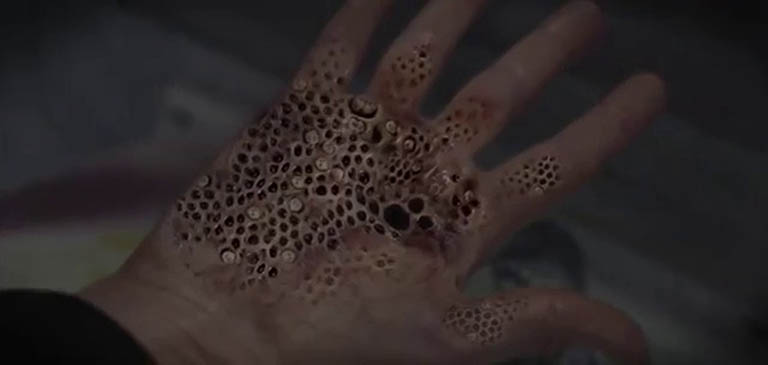 trypophobia là gì trypophobia là gì