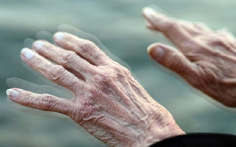 kích thích não sâu là gì kích thích não sâu là gì
