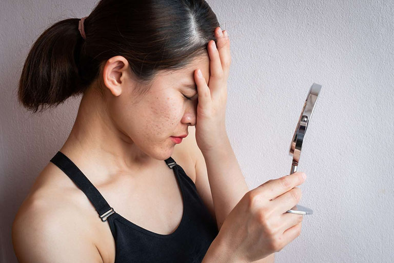 ảnh hưởng của Catoptrophobia ảnh hưởng của Catoptrophobia